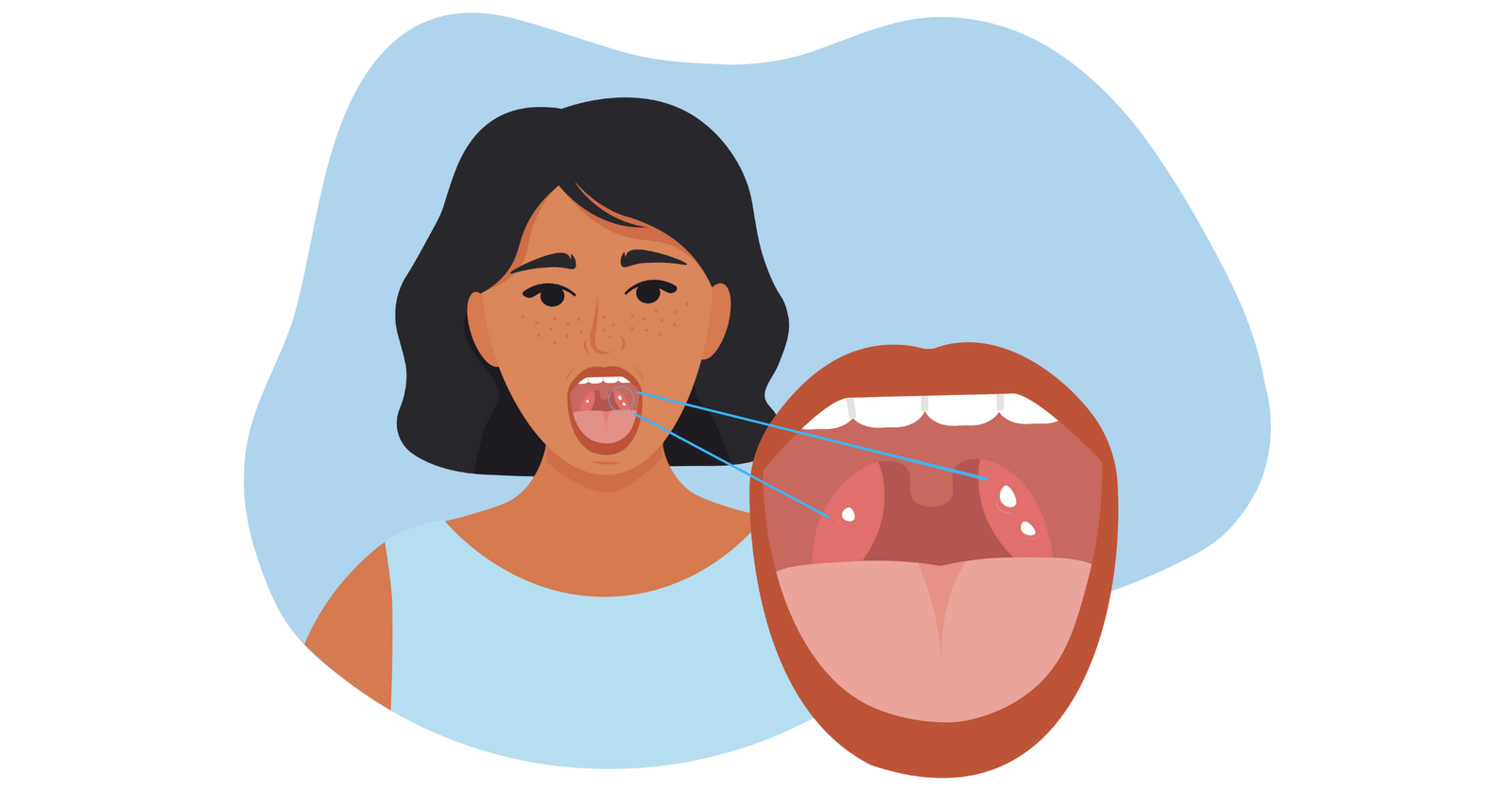 painful tongue images clipart